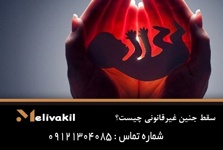 سقط جنین غیرقانونی چیست؟